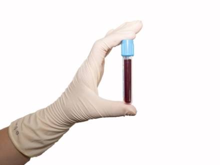 Maryland DUI defense lawyer